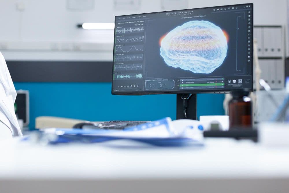 photologuephotos2023-08oficina-hospital-vacio-moderno-computadora-diagaram-cerebral-resonancia-magnetica-pantalla-listo-examen-oncologico-sala-gabinetes-equipada-herramientas-medicas-profesionales-imagen-tomografia-cerebraljpg