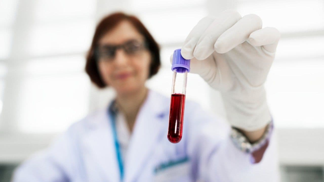 photologuephotos2024-11anemia_mitos_de_la_enfermedadjpg