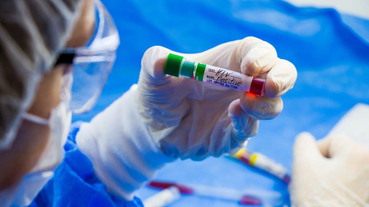 photologuephotos2025-04hiv-aids-infection-test-doctors-face-hand-holding-tube-with-blood-blue-background_1jpg