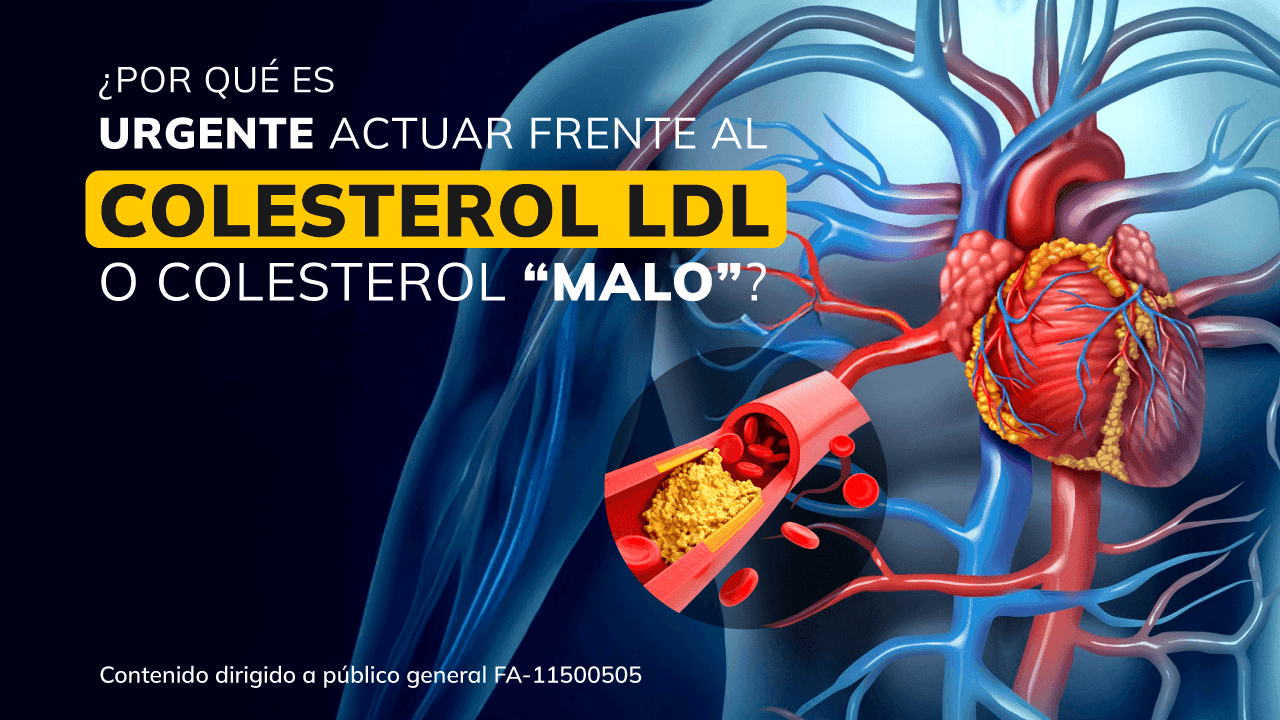 Webinar ¿Por qué es urgente actuar frente al colesterol LDL o colesterol “malo”?