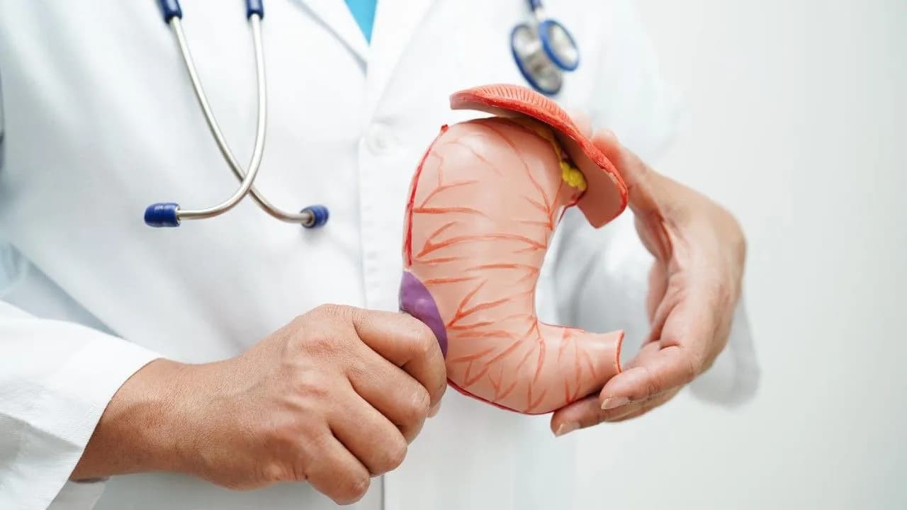 photologuephotos2024-12gastritis_cancer_de_estomagojpg photologuephotos2024-12gastritis_cancer_de_estomagojpg