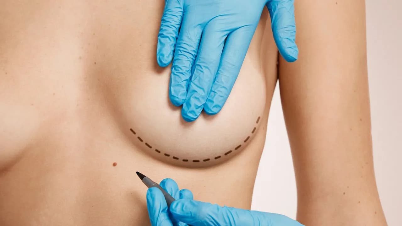 photologuephotos2022-10woman-marked-out-for-cosmetic-surgeryjpg photologuephotos2022-10woman-marked-out-for-cosmetic-surgeryjpg